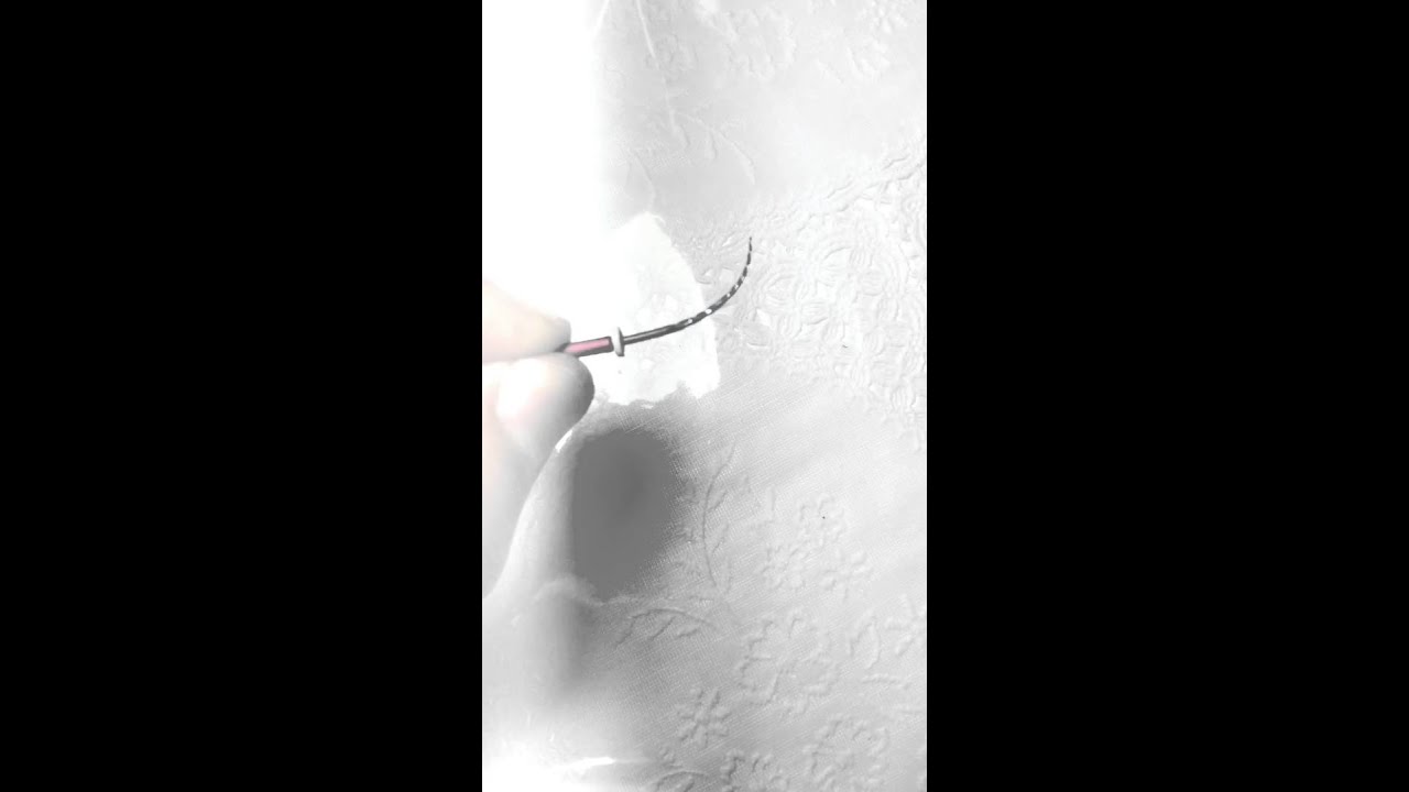 Leia mais sobre o artigo Endodontia Automatizada: A Revolução do Tratamento Dental!